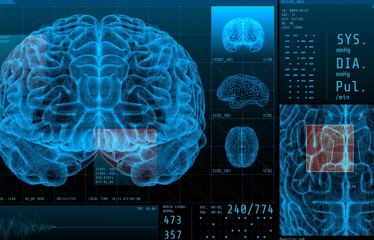 SITC Wie das Hirn filtert